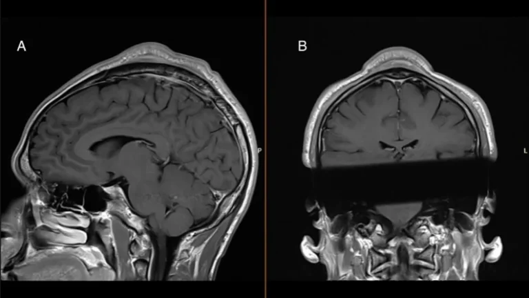 Good Medicine: New Medical Research Focuses on Breaking and Hip Hop